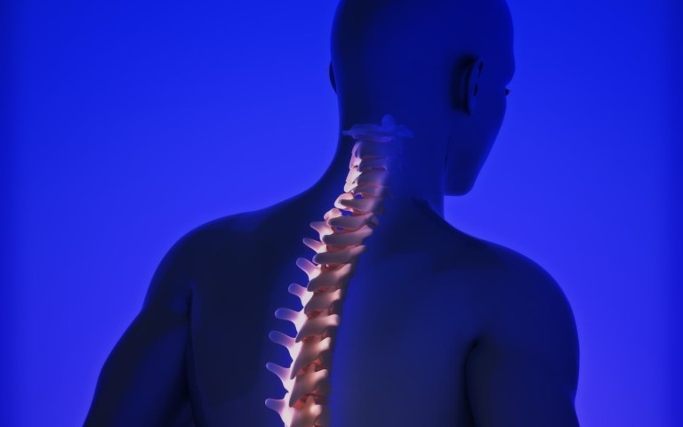 Atlas (c-1) Eje (c-2) Desalineamientos: Un factor subyacente contribuyente al síndrome de fatiga crónica